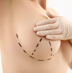 Breast Reduction
