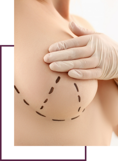 Breast Reduction
