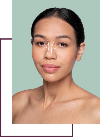 Rhinoplasty